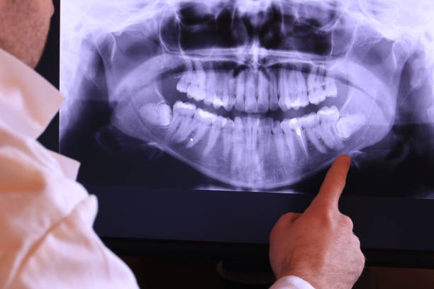 Best Emergency Treatment for Dental Infections or Abscesses in Northlakes, NC