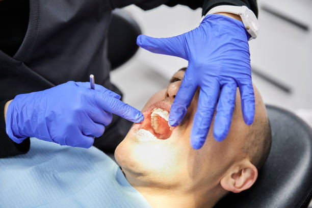 Best Emergency Treatment for Dental Infections or Abscesses in Northlakes, NC
